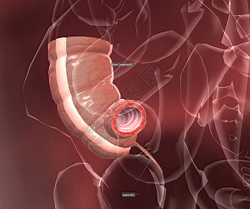 阑尾炎是指阑尾的炎症 指状囊从腹部右下侧的结肠突出情况痛苦癌症疼痛身体经期治疗压力医院厌食症图片