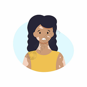一个面部和皮肤上有维利奥的可怜女人 世界维利奥戈日 皮肤疾病的治疗横幅医生女士感染药品细菌病人颜料斑点过敏图片