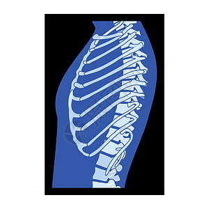 XRay Rib 笼子骨质素人体 -胸脊椎骨 骨骼成年人的伦琴侧视角图片