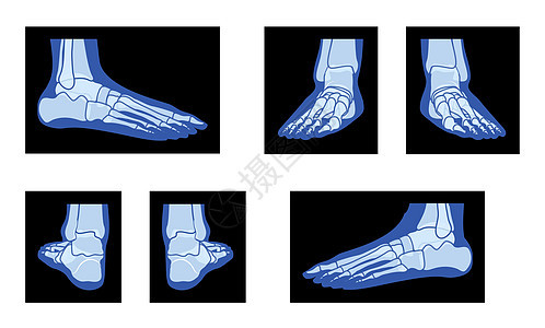 一组X光脚脚腿 骨质人体骨质成年人 伦琴前侧的三维现实蓝色平面图片
