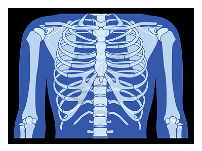 射线胸腔和手骨架人体骨骼成人伦琴前视图 3D 逼真平蓝色概念背景图片