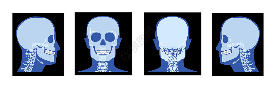 X光头和颈部 人体骨质成年人 伦琴前侧视角 三维现实的蓝色平蓝图片