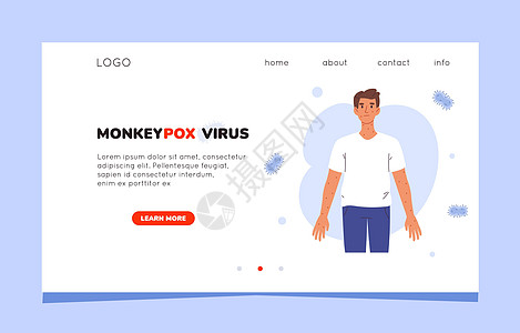 猴痘病毒症状登陆页面 猴痘病毒的网站模板 猴痘的症状 患有猴痘病毒的人图片