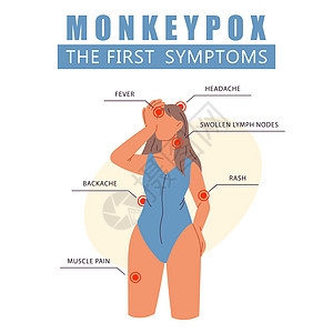 猴痘病毒的第一个症状 发烧 头痛 皮疹的妇女 带有猴痘病毒症状的信息海报 它会引起皮肤感染 平面矢量图图片