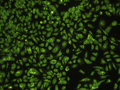 人类肺癌细胞药店医院显微镜实验绿色生物学药品实验室疾病危险图片