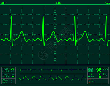 心脏监测屏幕监控心脏病学技术居住心电图医生展示监视器生活护士图片