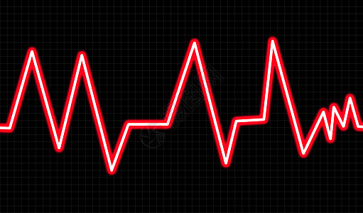 带波形网格海浪心脏黑色频率心电正方形监视器网格状心电图图形化图片