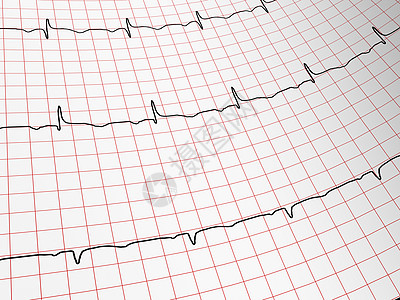 心电组脉动专家医院保健医疗药品测试医学心脏病服务图片