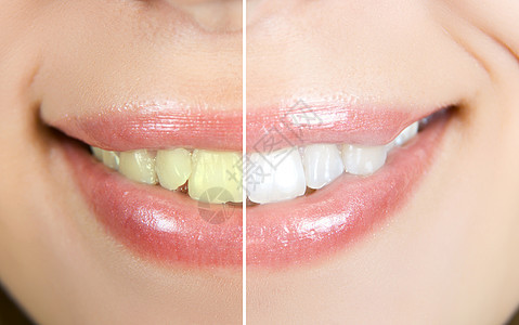 美白嘴唇化妆品牙齿牙医皮肤女士女性工具牙科女孩图片