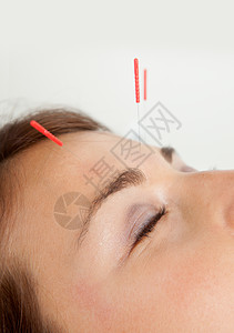 子宫针刺诊所职业皮肤治疗女士皱纹病人身体青年胶原背景图片