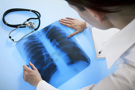 X光图像医生保健辐射医院外科白色考试医疗医师手术诊断图片