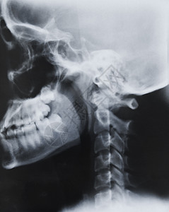 X光胶片骨骼医疗医院外科牙齿颅骨辐射解剖学椎骨考试图片