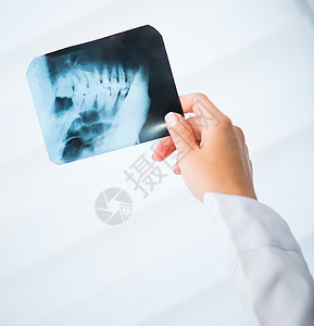 具有X射线的医生牙医药品牙疼扫描解剖学身体疾病骨骼手术口腔科图片