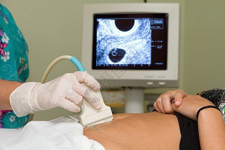 妊娠超声波背景图片