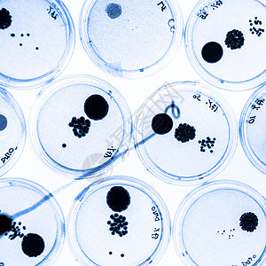 培里迪塞斯的细菌在成长科学殖民地生长生物病理化学技术药品细胞琼脂图片