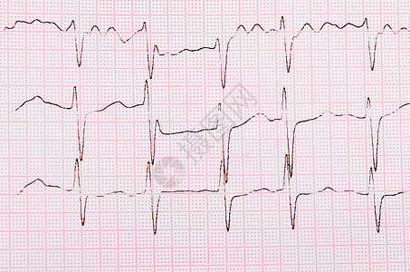 带一个男人的心脑图的磁带心脏疾病专家测试保健痕迹心脏病学医疗诊所诊断图片