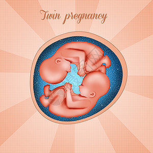 双胞胎超声波口碑母性胚胎怀孕子宫婴儿生育力女人科学药品图片