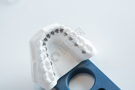 在白色的牙科下颌托架模型口腔科钛丝乐器门牙健康凹痕医生犬类办公室治疗图片
