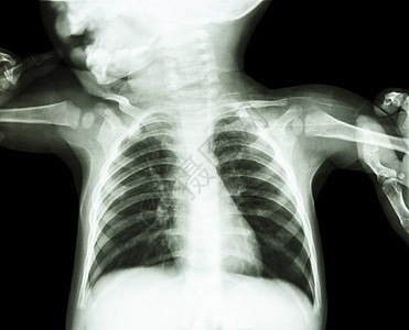 儿童与成人的双臂均系在儿童的手臂上胸部骨骼科学男生新生临床医院疾病身体考试图片