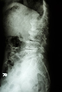 写着天主之神椎骨身体药品医院骨干脊椎保健放射科衰老手术图片