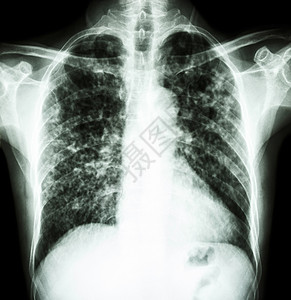 可入肺颗粒物健康人类高清图片