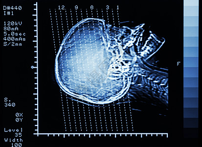 CT线卫生保健药品高清图片