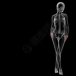 手骨x光放射性手势射线照相考试扫描药品放射科骨骼图片