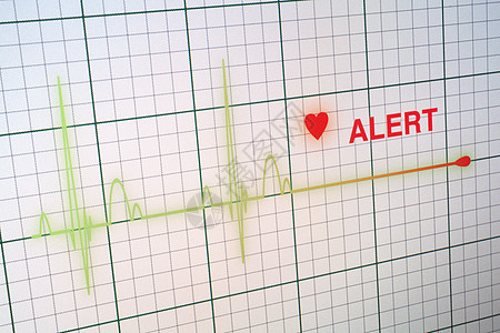 显示器上的心脏比心动图要强失败屏幕警报速度蓝色脉冲攻击技术逮捕电脑图片