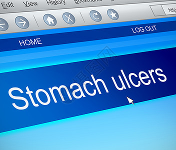 胃溃疡概念网站肠胃互联网屏幕网络技术插图溃疡电脑蓝色图片