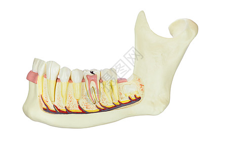 模型白底的牙齿被孤立的模拟人类下巴骨背景
