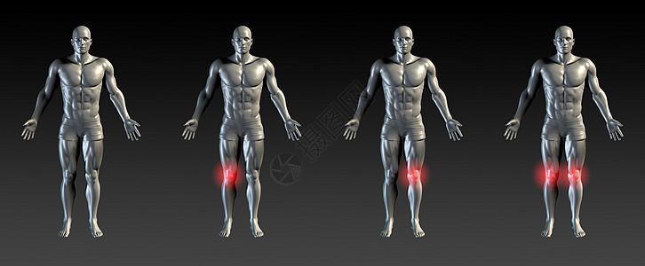 膝内伤害眼泪理疗x射线辉光收藏卫生列表运动男性疼痛图片