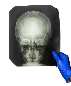 医生正在看X光考试儿科病人白色药品疾病解剖学诊断卫生检查图片