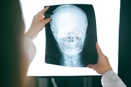 检查人头X光照片的女医生诊断外科骨科办公室x光诊所考试身体女士电影图片