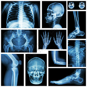 人体骨骼系统的一组X射线多重部分科学膝盖医院脊柱x射线骨科男人药品蓝色电影图片