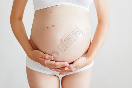 身穿白内裤 有许多胎记Nevus的孕妇儿子肚脐内衣婴儿女孩幸福家庭阳光父母胎记图片
