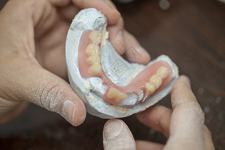 牙科化验室切牙假牙假肢图片