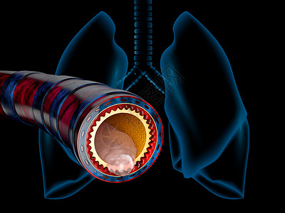 脊髓炎解剖学 粘结像3D插图一样隐密如胸冷支气管炎治疗粘液紧缩疼痛松紧度咳嗽支气管保健解剖学图片