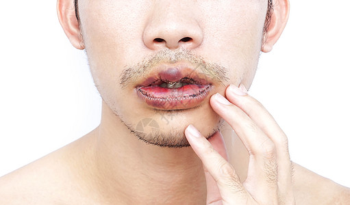 男人嘴唇上下加整容手术 美貌体积男性注射器化妆品皮肤医疗尺寸切口雕刻不对称图片