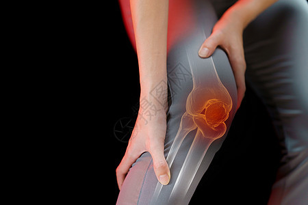 紧紧关紧的年轻女子膝盖疼痛身体扭伤腿骨肌肉症状保健治疗女士按摩痛苦联合的高清图片素材