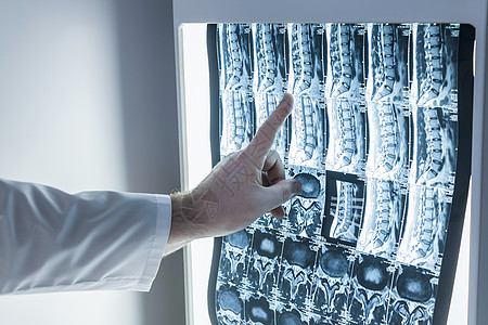 神经学家和外科医生检查患者的脊柱图像图片