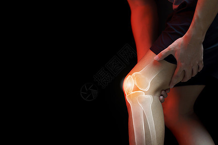 医疗概念 膝膝痛的人  骨架xr身体按摩伤害治疗腿痛痛苦女性药品女士肌肉红色的高清图片素材