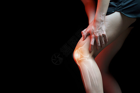 医疗概念 妇女膝膝受痛     骨架压力身体按摩疾病女性解剖学肌肉医生膝盖症状伸展高清图片素材