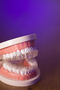 具有透明整牙剂的假体牙齿牙医卫生矫正假肢假牙白色医生健康医疗图片