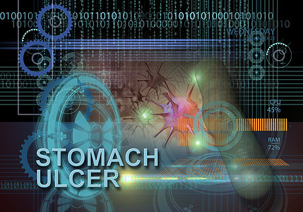 胃溃疡医疗高科技技术科学圆圈肠胃医学插图疾病数据图片
