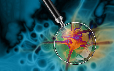纳米汗蒸致癌细胞细胞癌症宏观放大镜绘图卫生疾病保健细胞细菌医疗背景