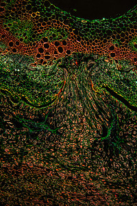 黑暗球场中的恶魔线寄生虫横跨100区暗场细胞魔鬼腐烂麻线黑色组织学植物学科学红色图片