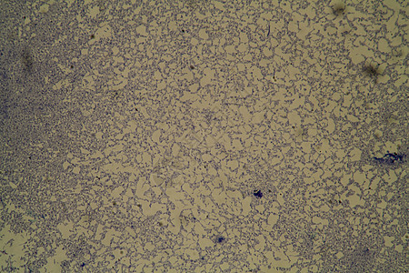 显微镜下沙门氏菌病原体 200x病菌筷子科学感染疾病背景图片