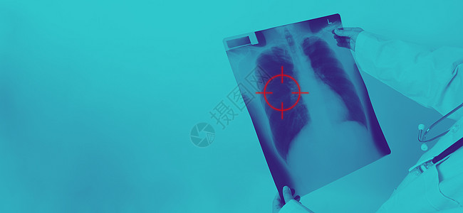 亚洲女医生持有和检查肺部X光片扫描医院测试关心肺炎癌症胸椎结核专家射线图片