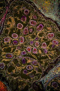 Echnoccus 寄生性肝脏流感放大 100x病理组织学暗场宏观寄生虫肝细胞水蛭科学热带疾病图片