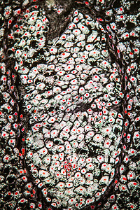 第100节交叉部分的灭雾植物浆果寄生虫尺寸宏观组织学暗场薄片生长生物学施肥图片